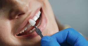 dental sealants and school age children what parents should know